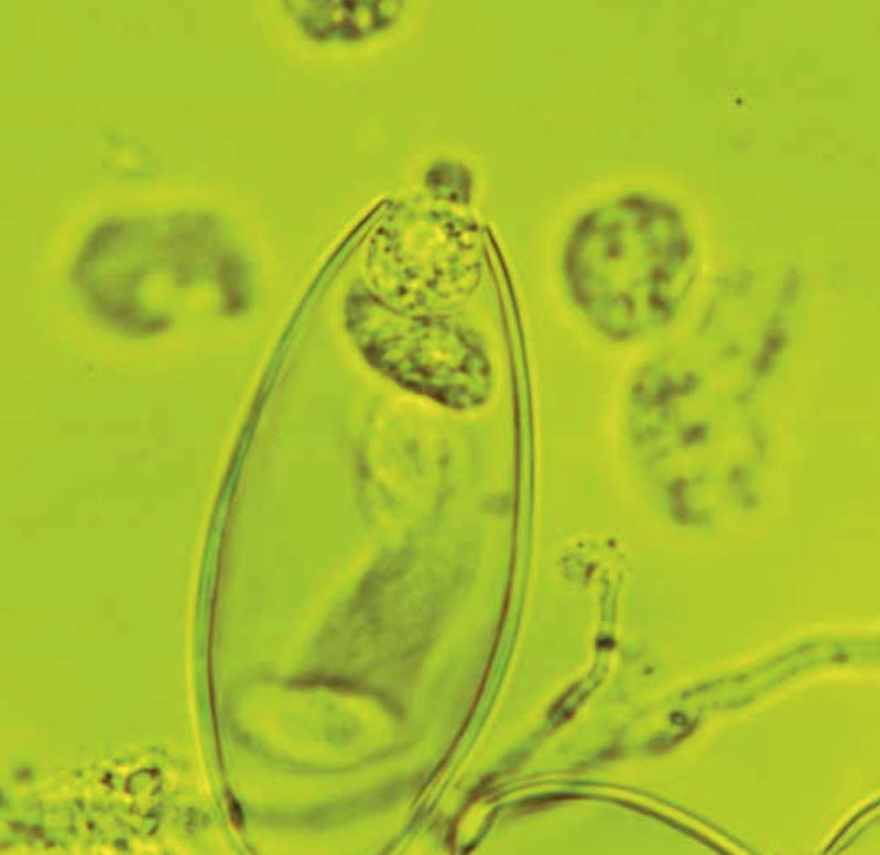 Phytophthoraramorum